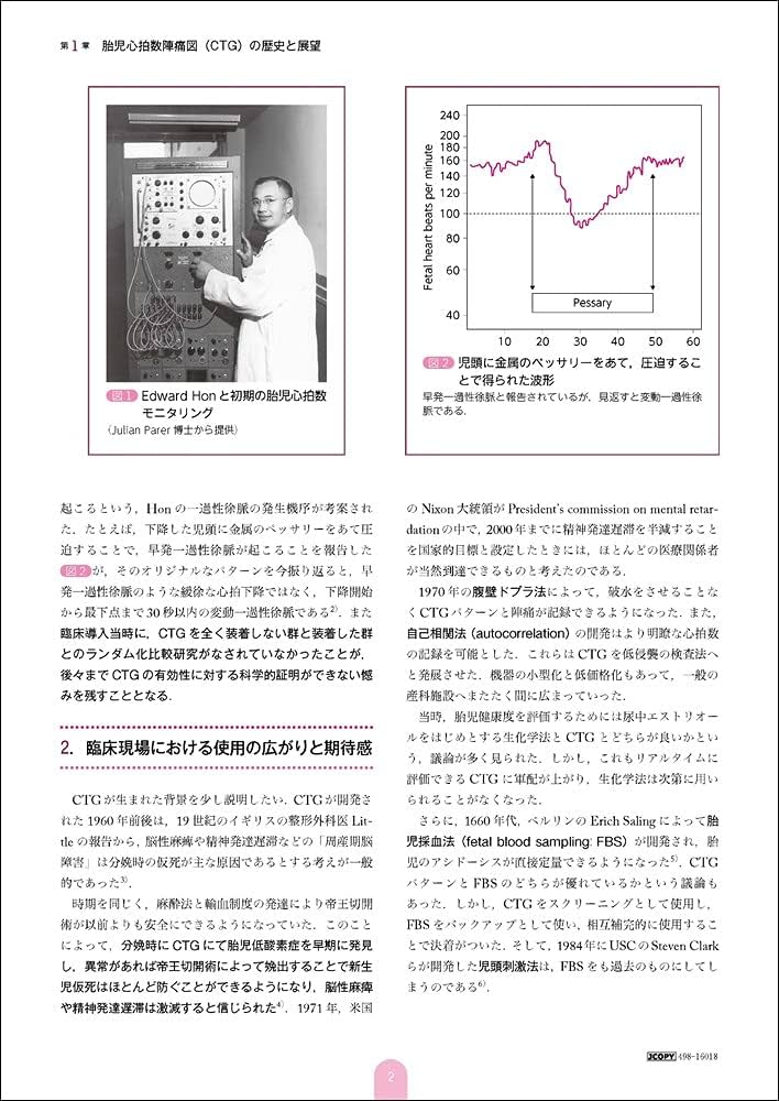 【裁断済】CTGエボリューション CTGエボリューション -胎児生理学からコンピュータ判読まで